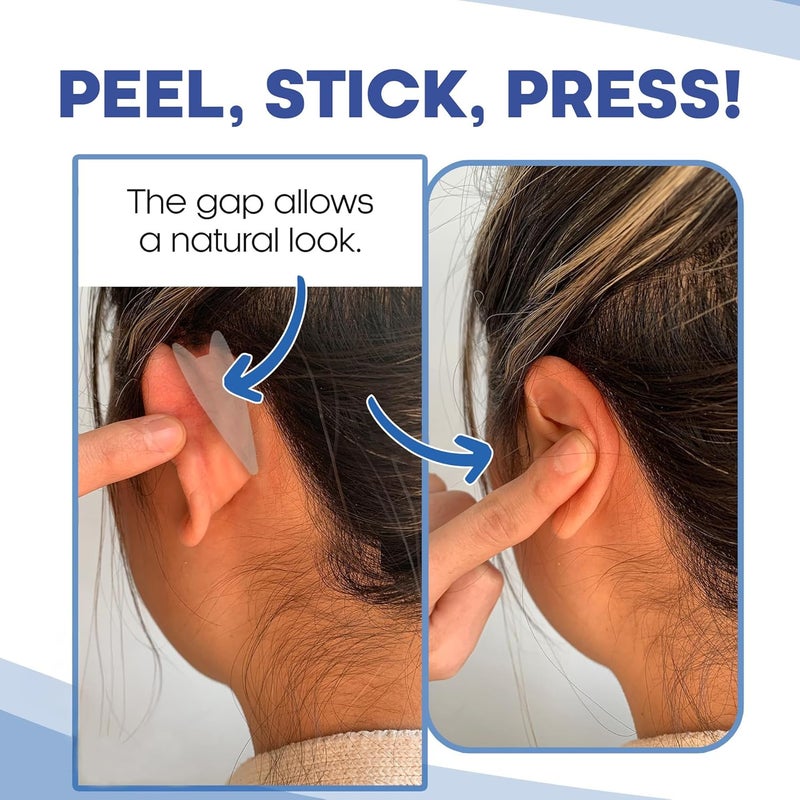 Earo مصحح الأذن التجميلي EarPro – لاصقات لاصقة أقوى، تثبت الأذنين البارزتين بدون جراحة – لاصقات غير مرئية ومقاومة للماء للبالغين لتصحيح وضع الأذن – عبوة 20 – حجم واحد شفاف - Image 3